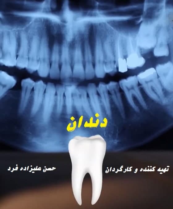 مستند دندان